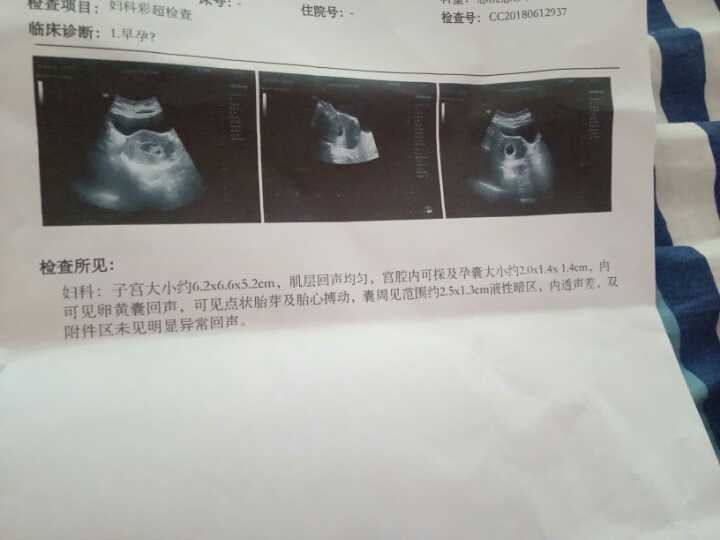 成都哪找代生,广州供卵试管机构：除了选性别，泰国第三代试管还有这些好处！